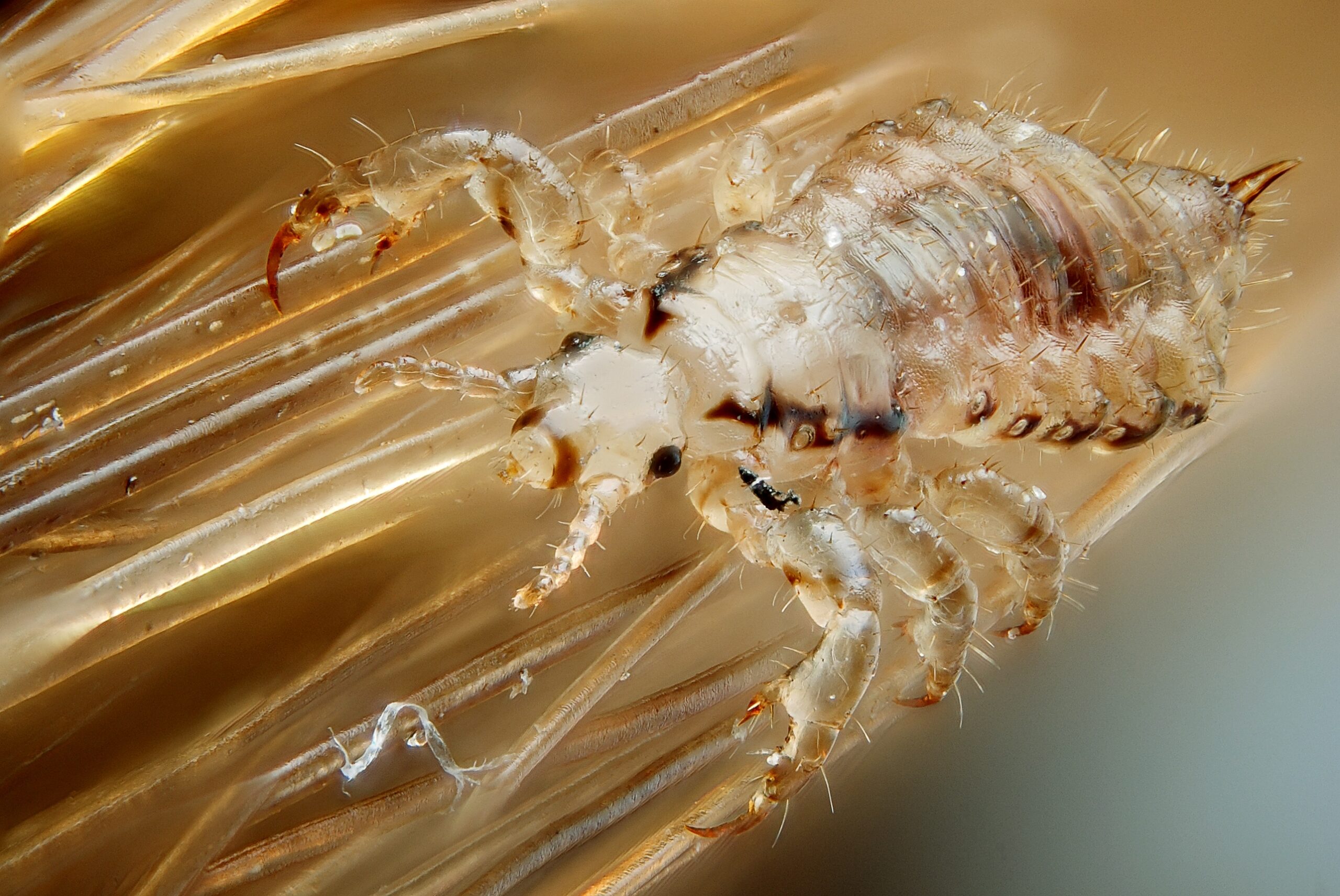 Understanding and Treating Head Lice Effectively